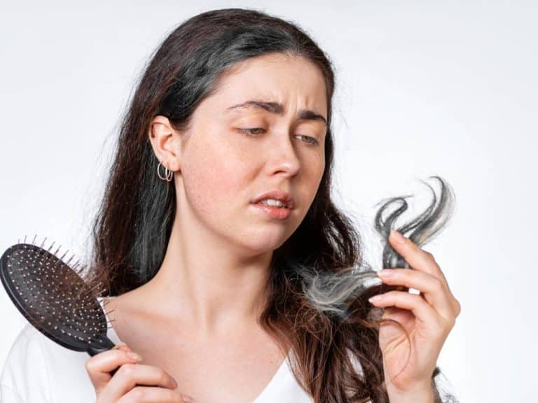 spiritual-meaning-of-white-streak-in-hair-mallen-streak-poliosis
