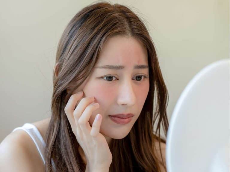spiritual-reasons-for-skin-problems