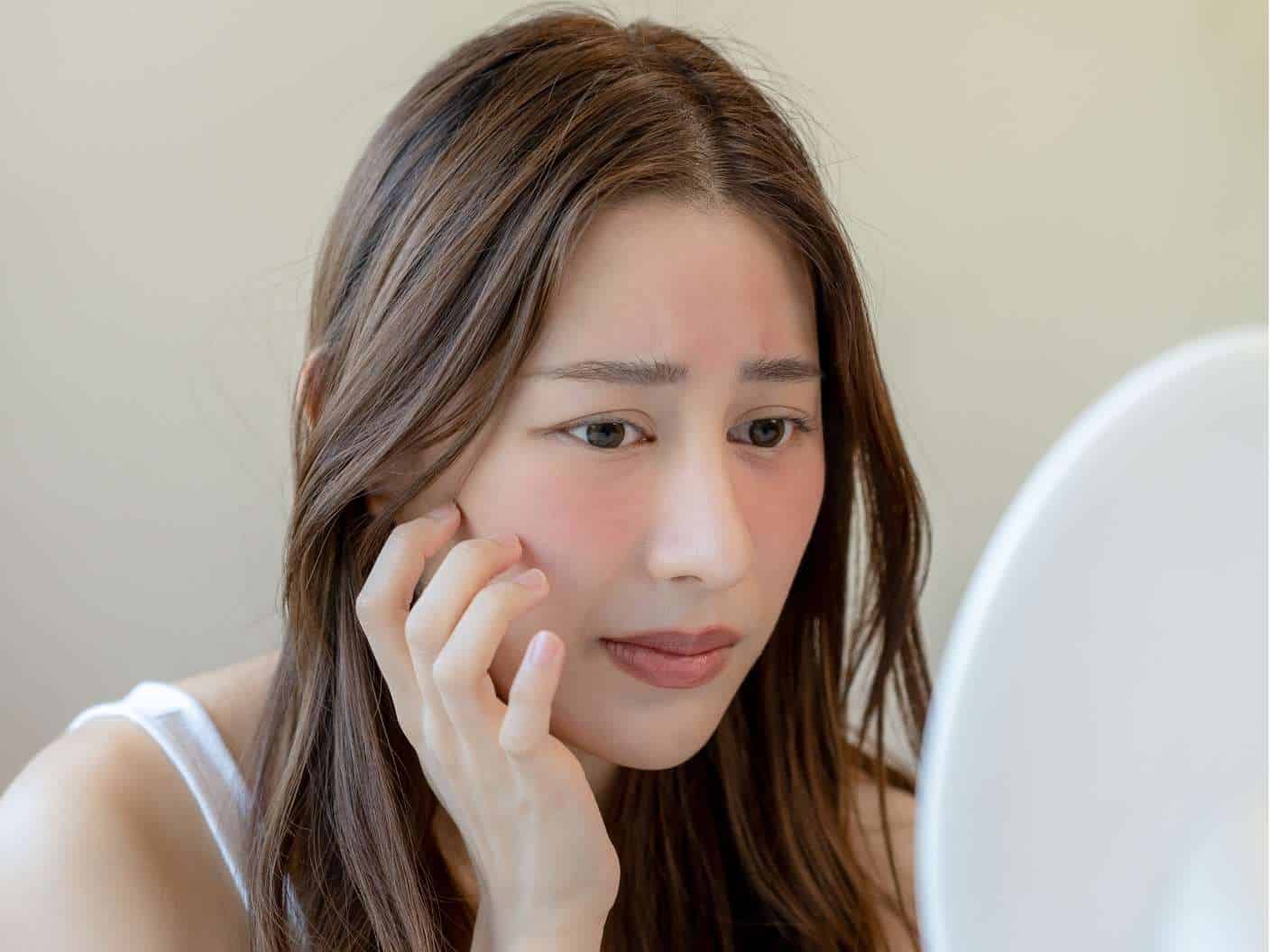 spiritual-reasons-for-skin-problems