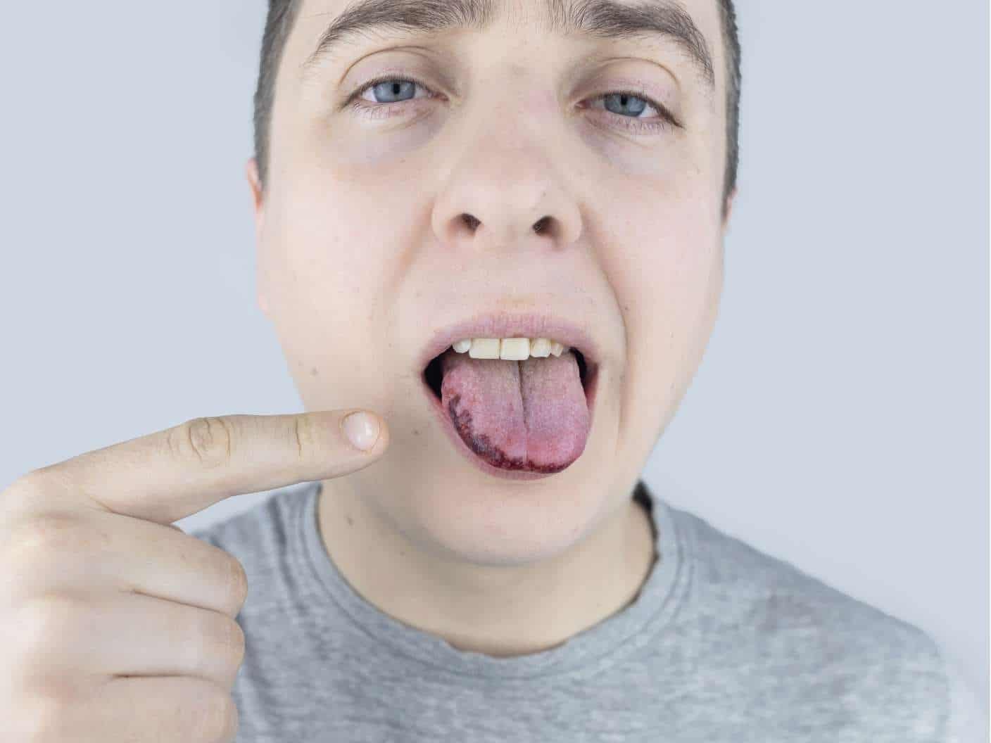 spiritual-meaning-of-black-spots-on-the-tongue