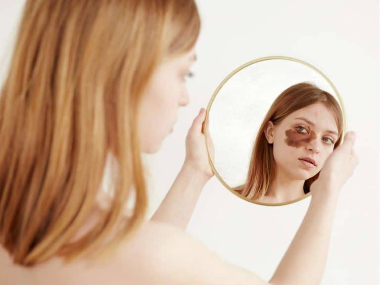 spiritual-meaning-of-mongolian-birthmark-spot-myths
