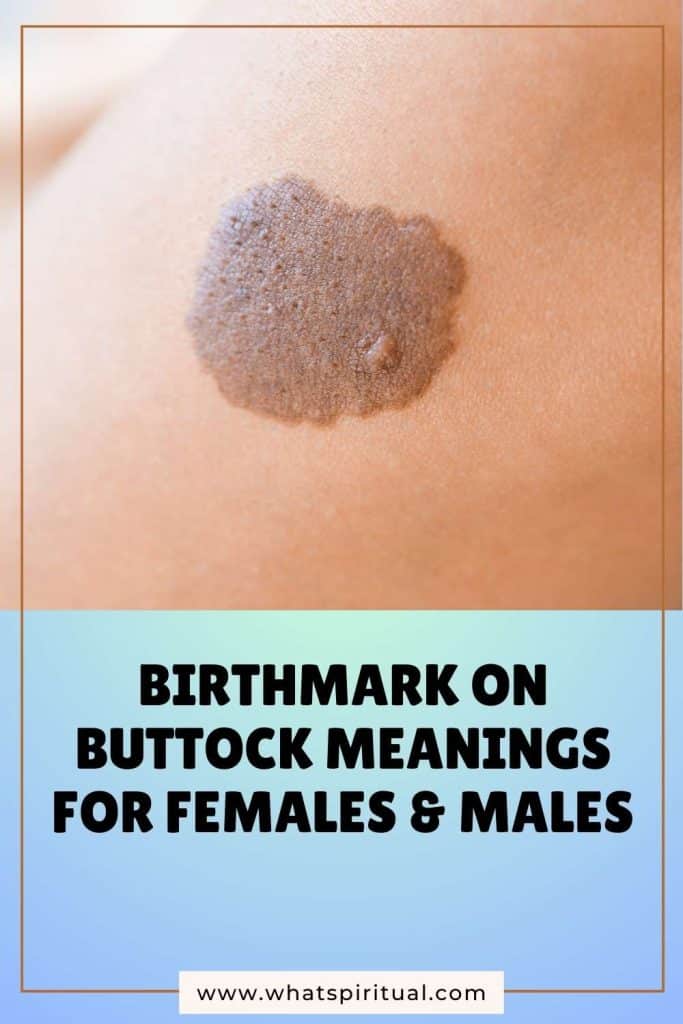 what-is-the-meaning-of-birthmarks-on-buttock-for-females-and-males