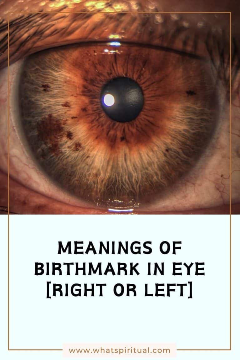 Meanings of Birthmark in Eye [Right or Left Eye Freckle] - What Spiritual