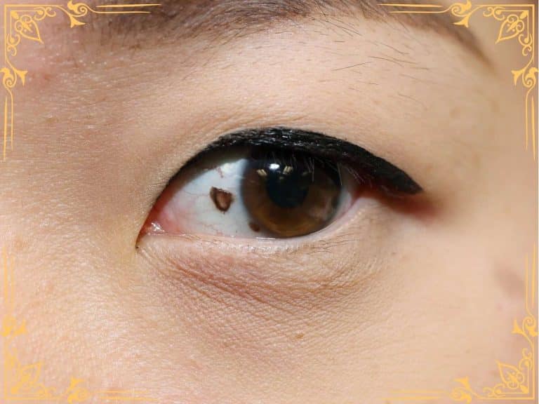 Mole in Eye Meaning: Eyeball, Eyelid, Eyebrow Moles 