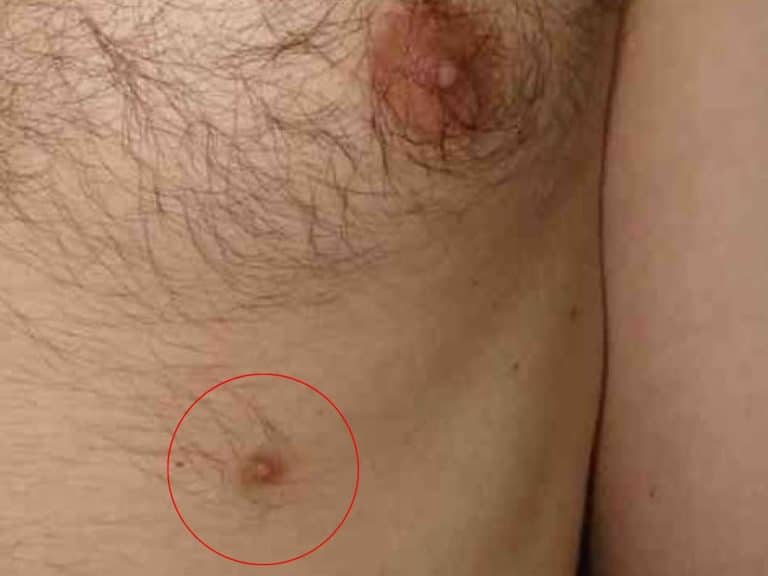 spiritual-meaning-of-third-nipple-power-mythology